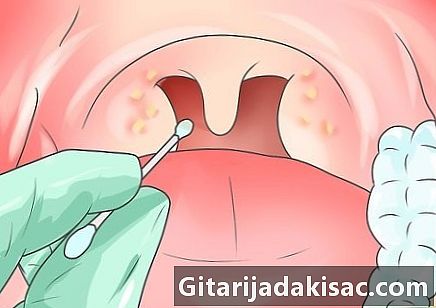 Como realizar um cotonete na garganta