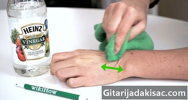 كيفية إزالة علامات القلم على الجلد