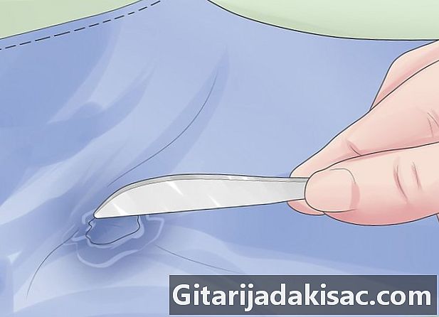 Como remover chicletes de suas roupas