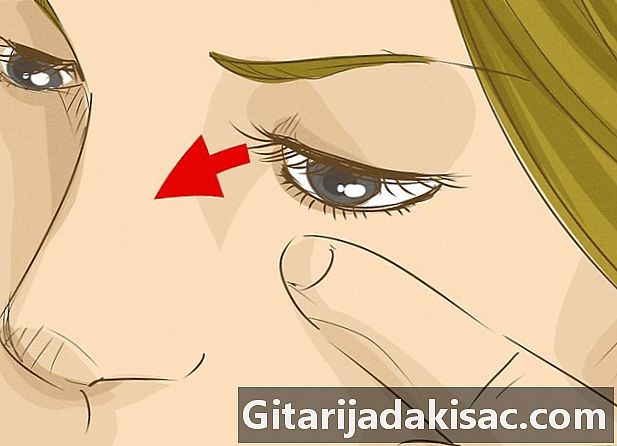 Cum să îndepărtați o gură din ochi