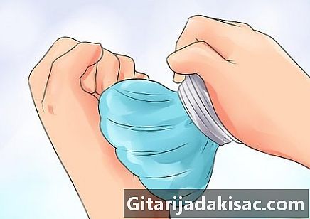 Kako narediti vaje po operaciji karpalnega kanala