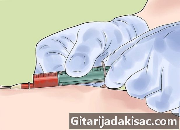 Cách kiểm tra nguyên nhân nhiễm trùng do MRSA