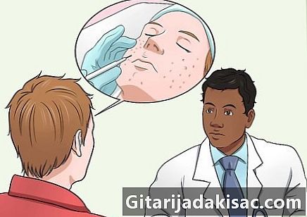 Wie man Aknenarben von seinem Gesicht entfernt