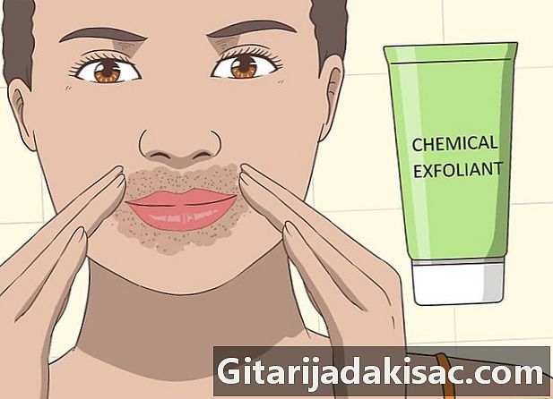 كيفية إزالة البقع الداكنة حول الفم