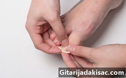 Πώς να απορροφήσετε ένα ενσωματωμένο toenail