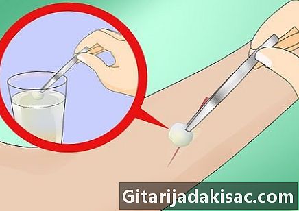 Cómo hacer un desinfectante para heridas superficiales