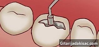 Cómo hacer un aparato de ortodoncia falso (brackets)