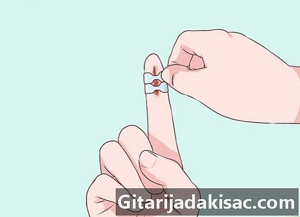 איך להכין תחבושת על אצבע או אצבע פצועה