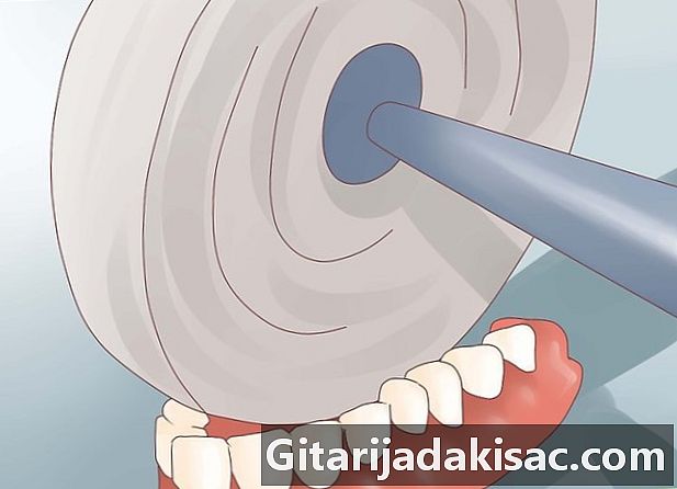 Bir diş protezi nasıl dosyalanır