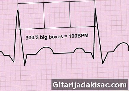 Bagaimana membaca EKG