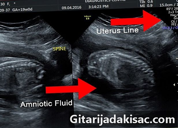 Jak číst ultrazvuk